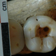 Illustration for article titled Details of Earliest Human Dentistry Make Me Want to Cry
